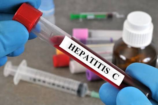 فحص التهاب الكبد سي (HCV) في المنزل في دبي